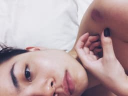 kyliebites